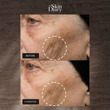 Load image into Gallery viewer, The Skin Diary - Night Repair Therapy
