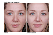Load image into Gallery viewer, Obagi Blue Peel RADIANCE