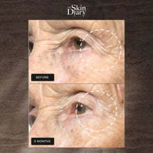 Load image into Gallery viewer, The Skin Diary - Night Repair Therapy
